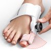 Állítható bütyök korrigáló sín, Hallux Valgus bandázs