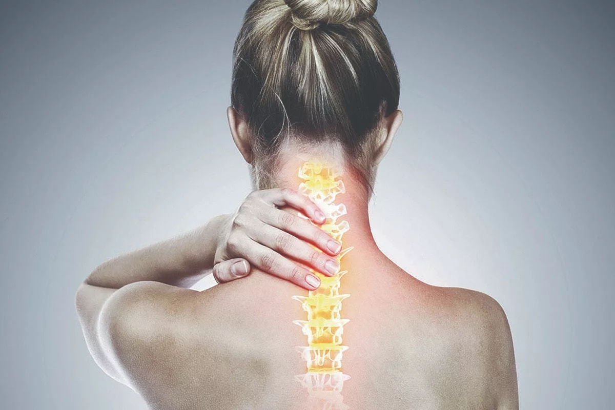 Mi a nyaki spondylosis és mik a tünetei? - Ortek